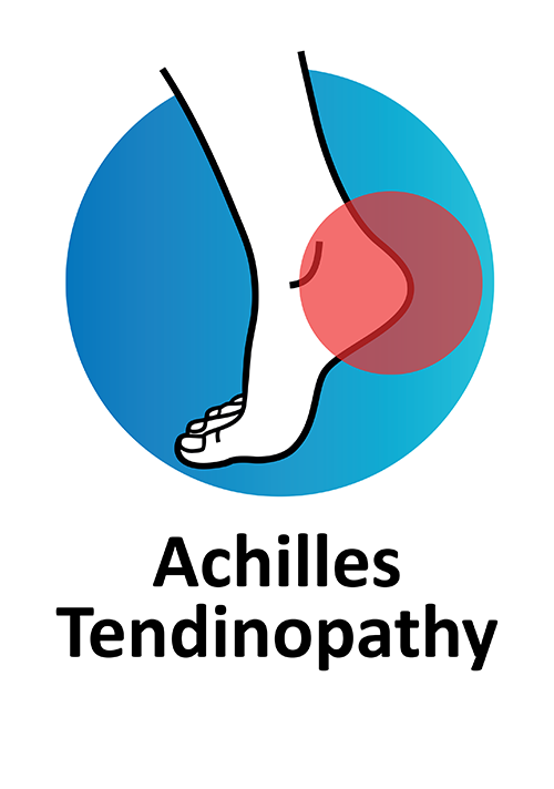 Achilles Tendinopathy